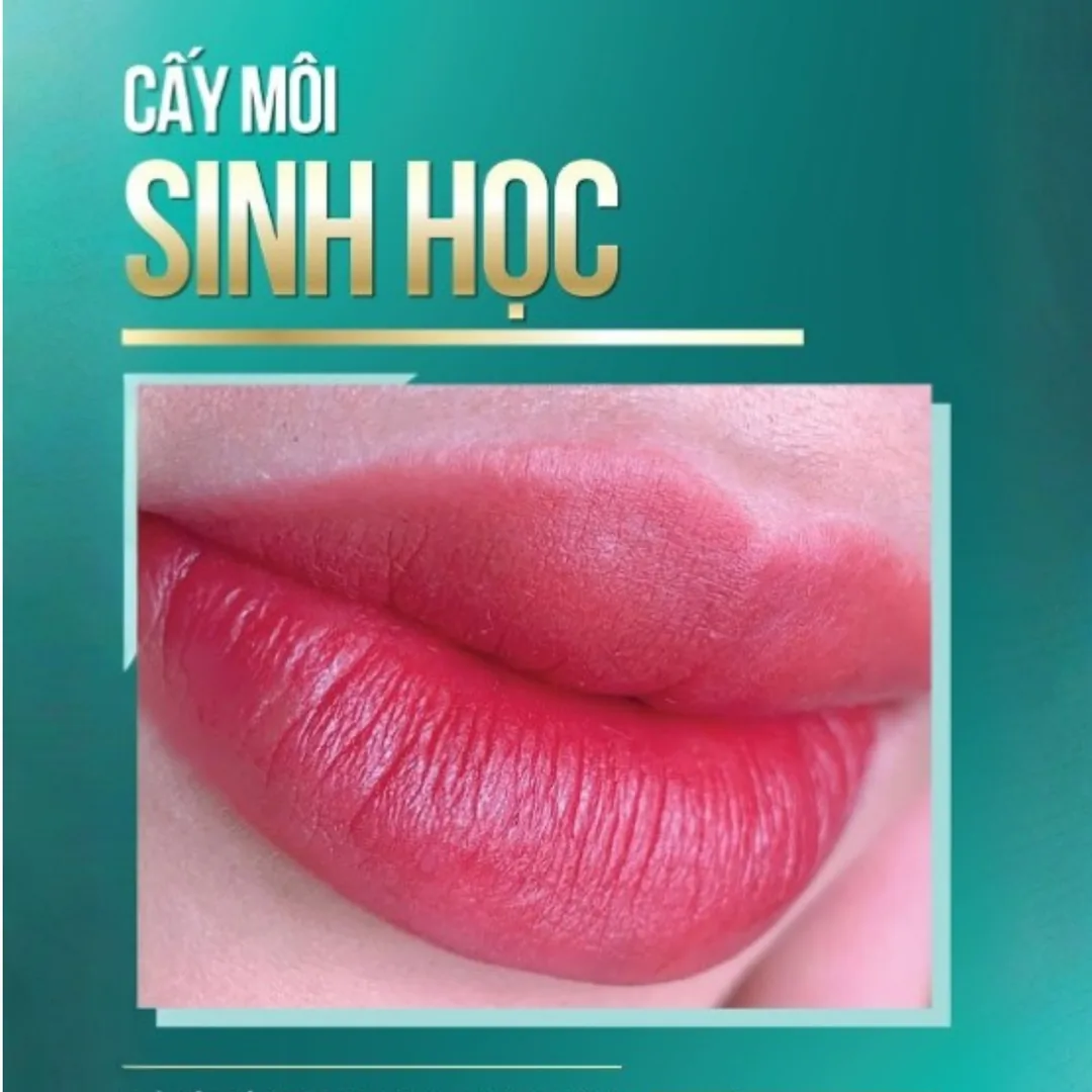 Các dịch vụ phun môi nổi bật tại TMV Hoài Anh
