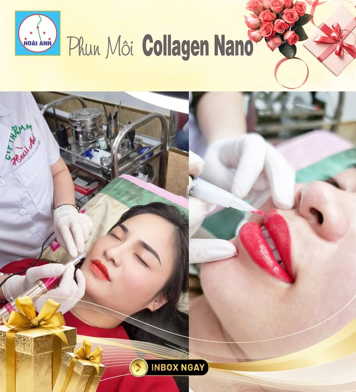 Phun môi Collagen cải thiện môi thâm tại Thẩm Mỹ Viện Hoài Anh