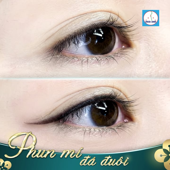 Phun mí đá đuôi tạo điểm nhấn ở góc ngoài mắt tại Thẩm Mỹ Viện Hoài Anh