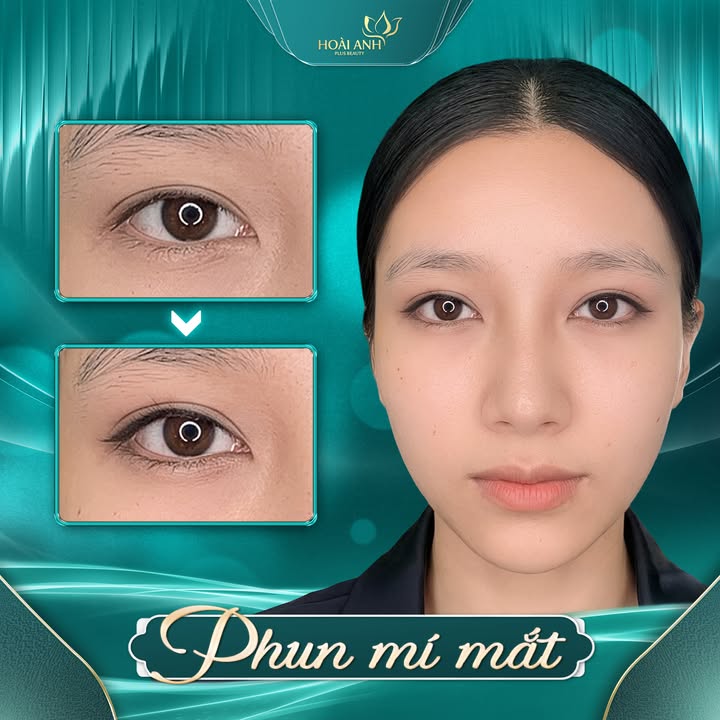 Phun mí sắc sảo tạo đôi mắt to tròn cuốn hút tại Thẩm Mỹ Viện Hoài Anh