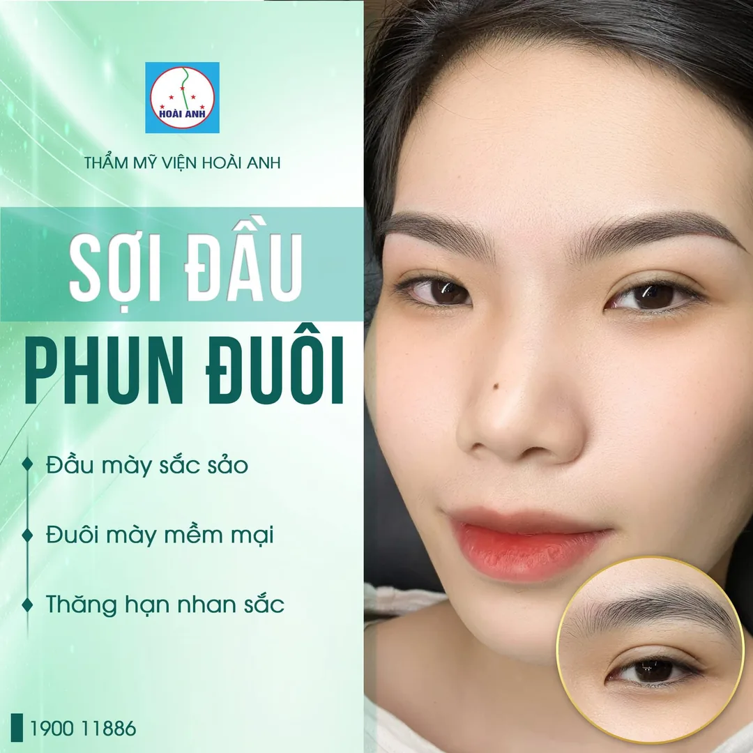 Kỹ thuật chuyên viên Thẩm Mỹ Viện Hoài Anh — quy trình giảm đau chuẩn