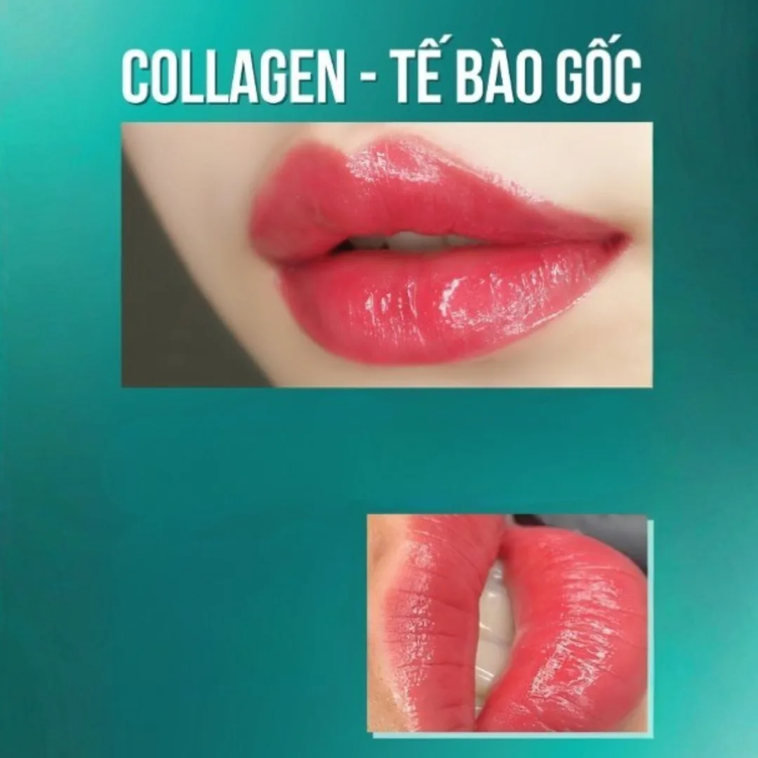 Các dịch vụ phun môi nổi bật tại TMV Hoài Anh