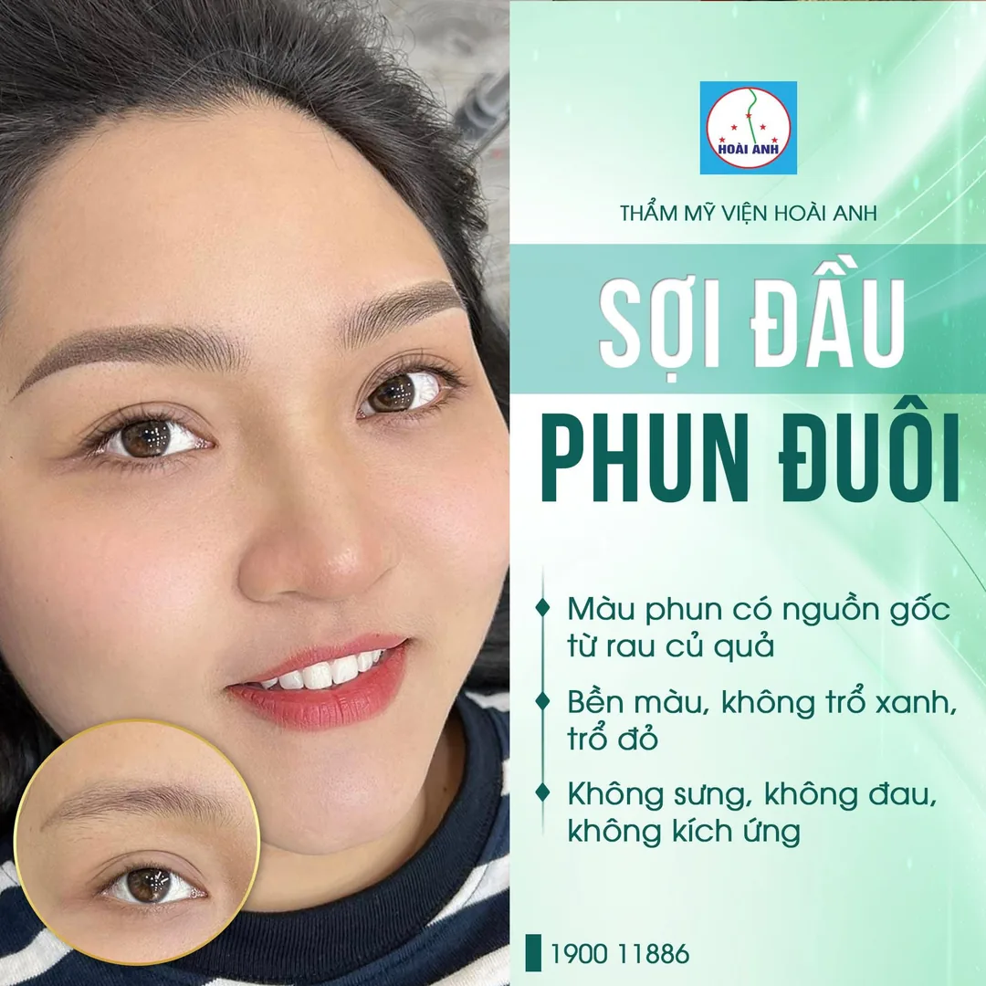 Kỹ thuật đi sợi hairstroke đan xen tự nhiên tại Thẩm Mỹ Viện Hoài Anh