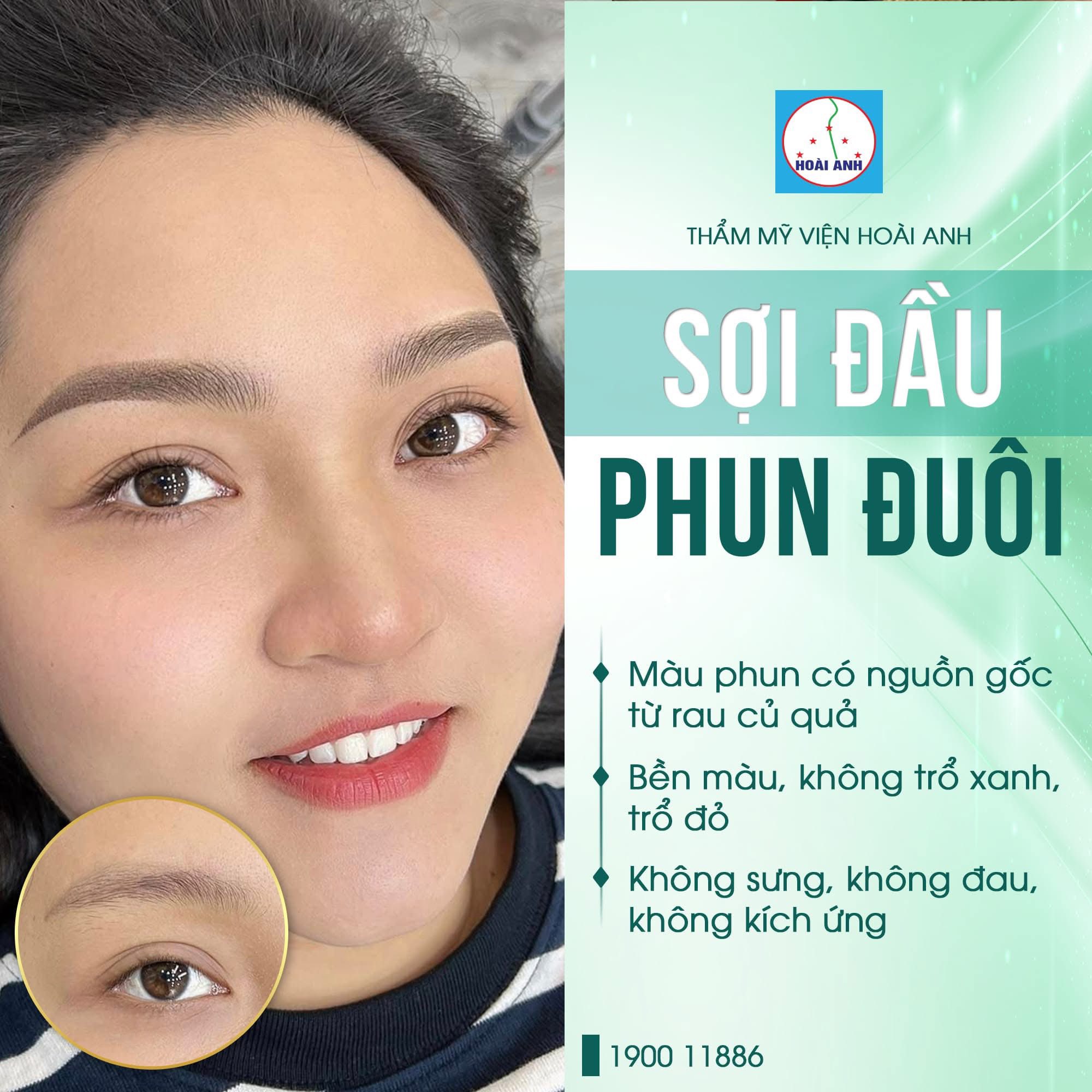 Sợi Hairstroke đan xen với chiều mọc tự nhiên tại Thẩm Mỹ Viện Hoài Anh