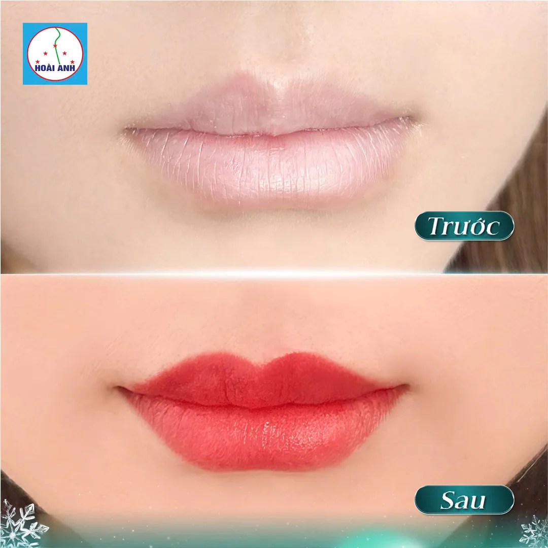 Dịch vụ phun môi tại Thẩm Mỹ Viện Hoài Anh